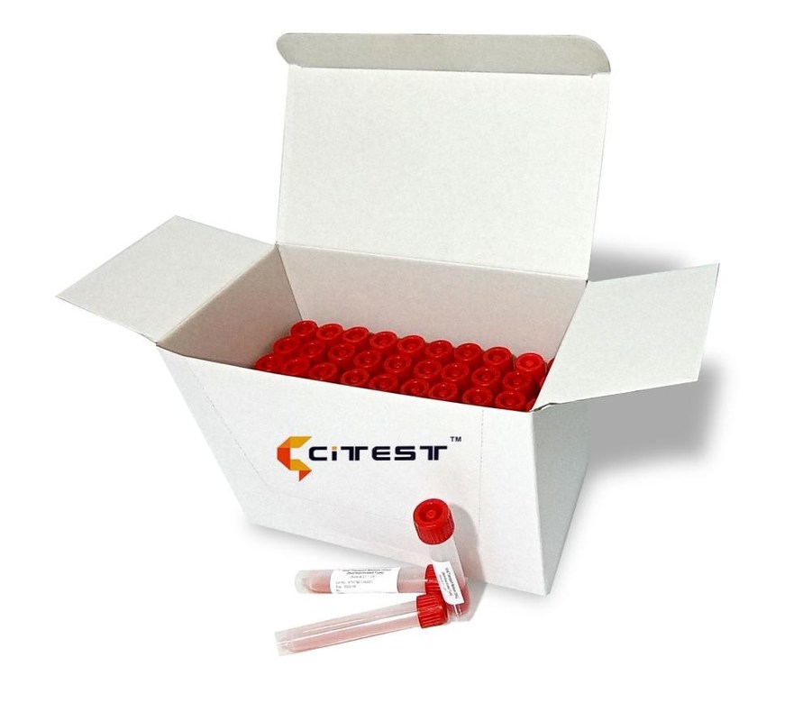Laboratory Biochemistry Test Kit Non Inactivated Viral Transport Medium Vtm Test Kit